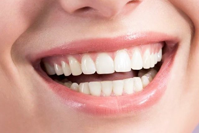 gum lift can transform your smile