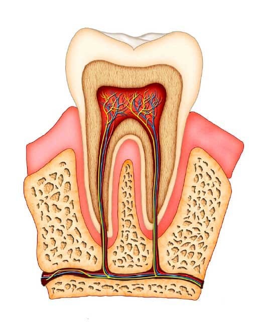 Root Canal Cost Sydney