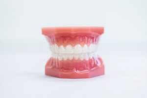 Remember Metal Braces? Straighten teeth without them