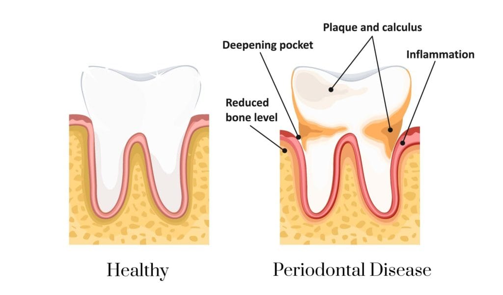 healthy gum diagram