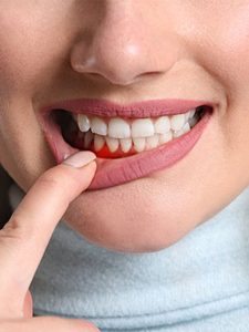 gum disease treatment guide