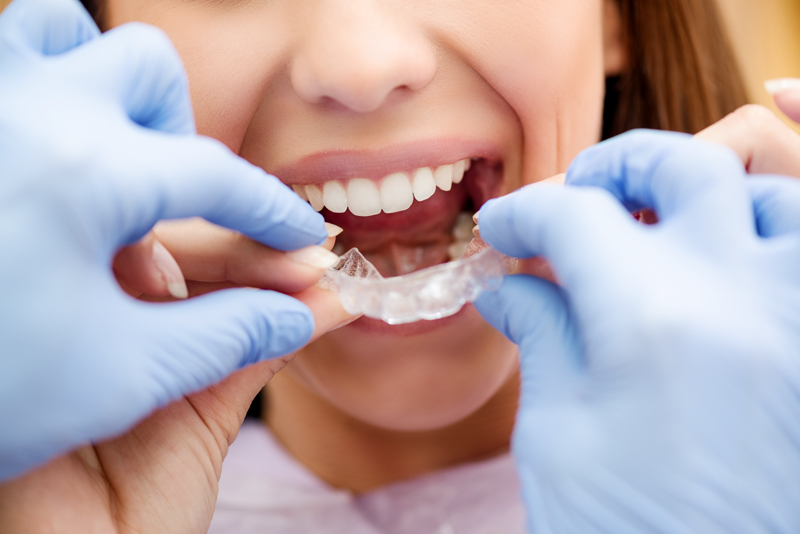 Pro Tip: 21 Tips for Braces Success in 2021