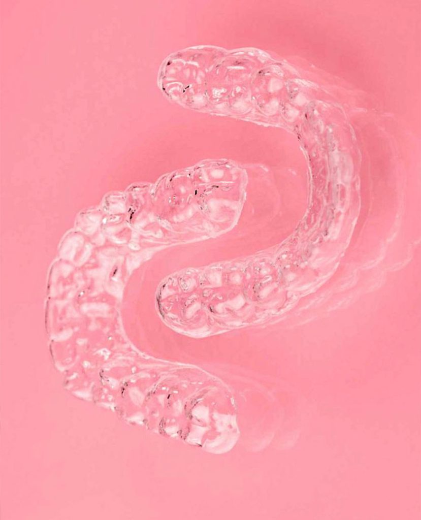 Truth Revealed: Braces vs. Invisalign - We’ll Find Your Match