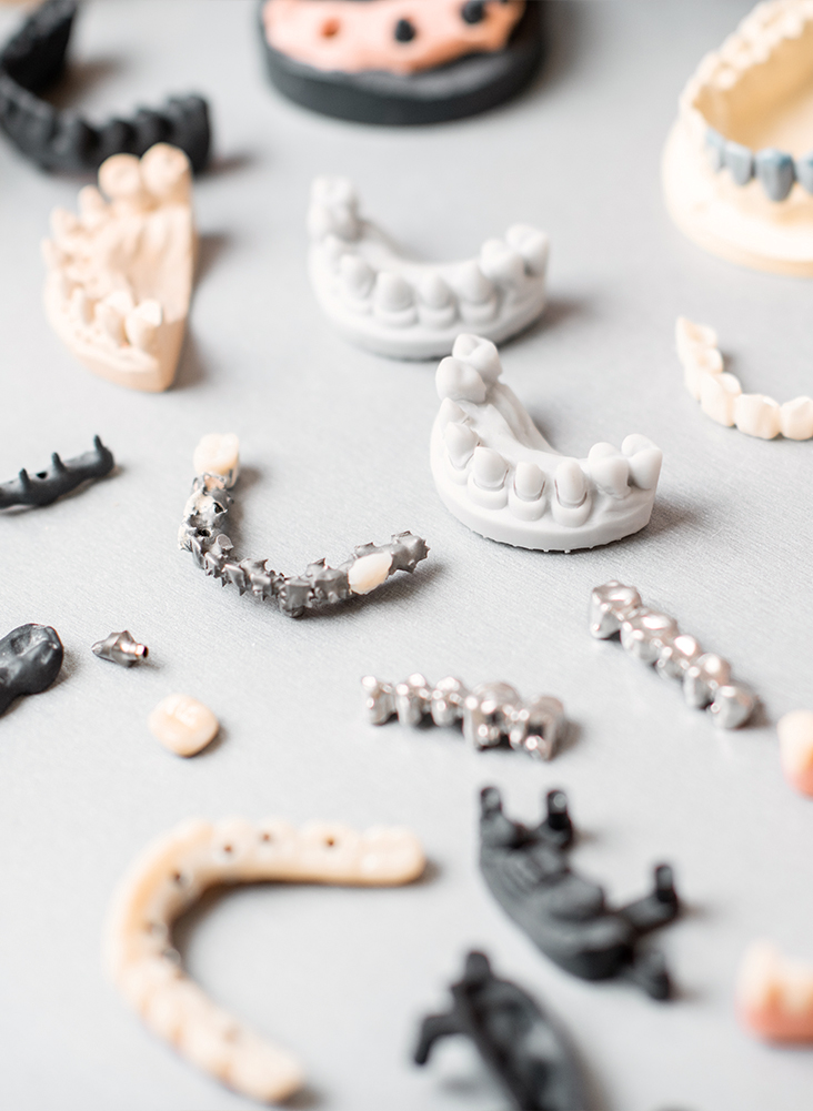 dental-implant-on-model