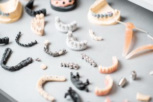 dental-implants-on-model