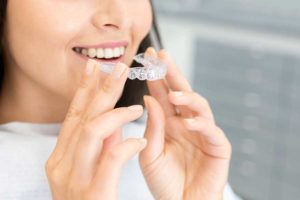 Invisalign Or Veneers: Which One Is Best For Crooked Teeth?