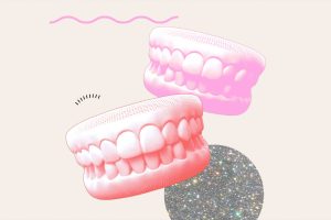 Invisalign Or Veneers: Which One Is Best For Crooked Teeth?