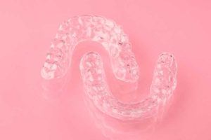 Top 3 Best Invisible Braces In 2022: You Will Be Surprised By The 3rd