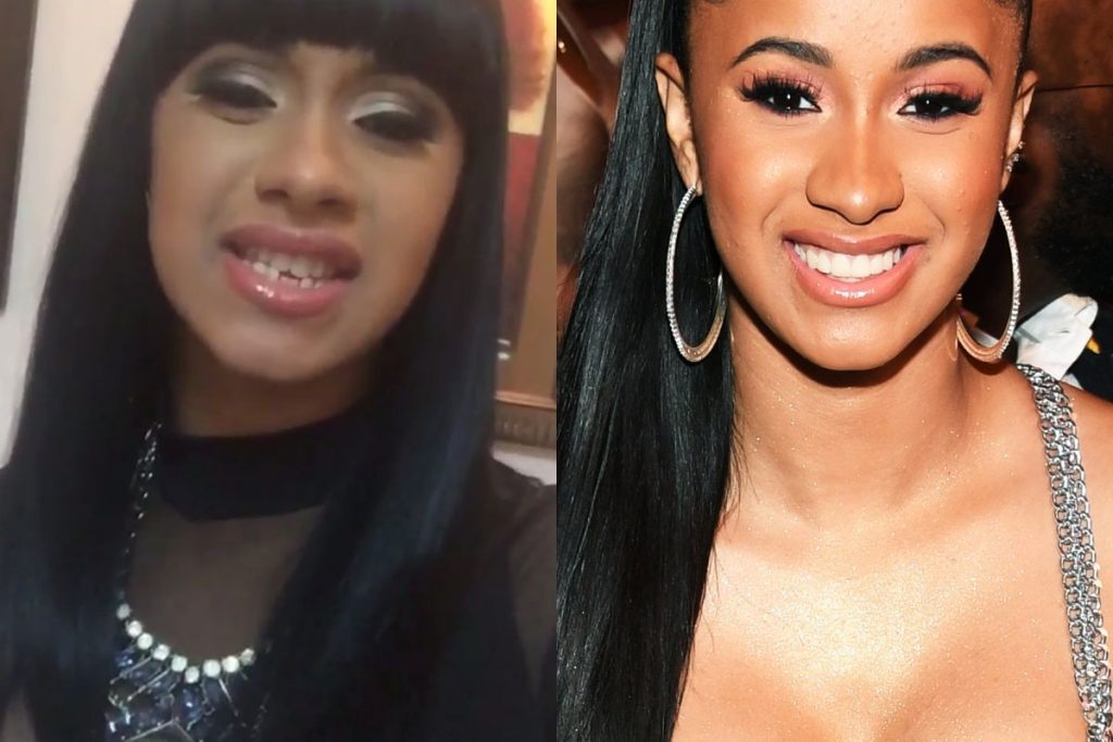 cardi b with veneers celebrity with veneers
