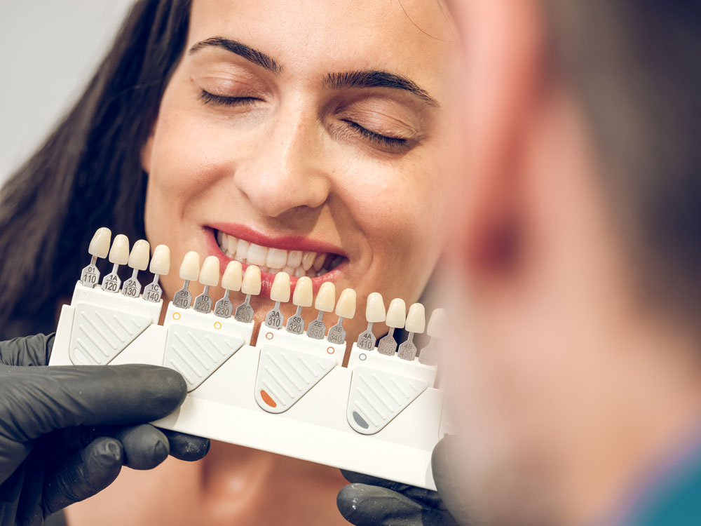How Much do Veneers Cost for a Full Set?