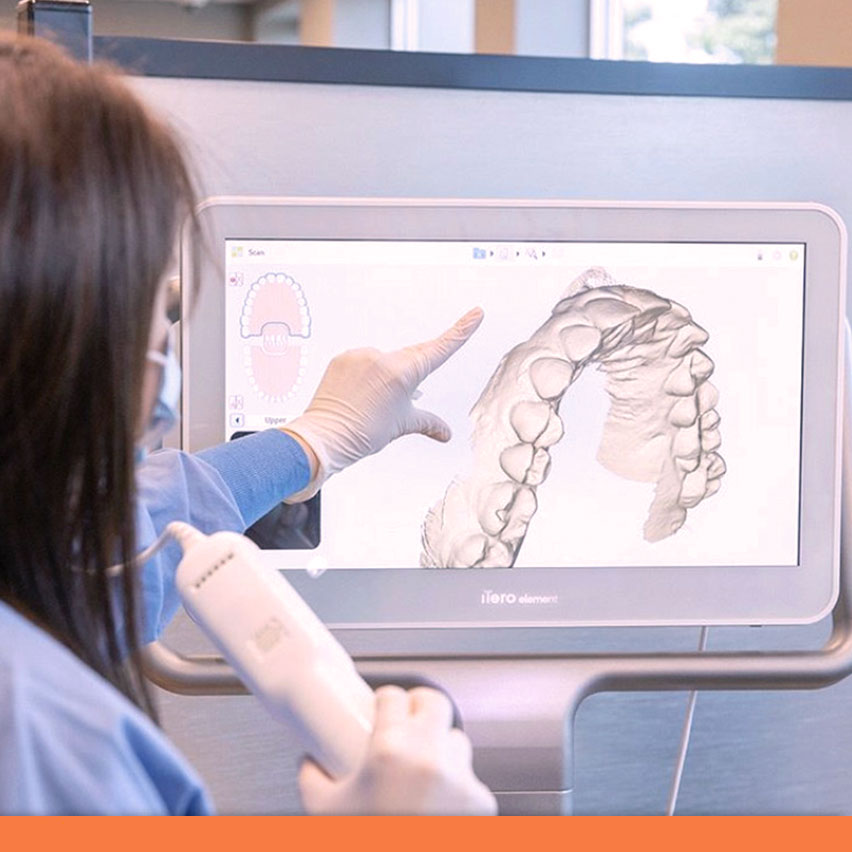 A graphic for Step 1 of Invisalign. Smile Concepts uses this for the start. The visual is beginning. The theme is getting started. The alt text marks the exciting beginning of the Invisalign process, highlighting the initial consultation and scan that kicks off the smile transformation.