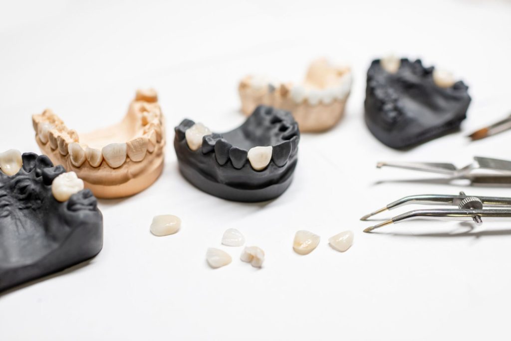 artificial-jaw-models-with-porcelain-veneers