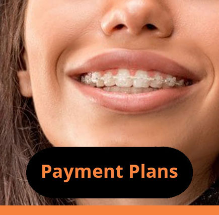 clear braces with payment plans