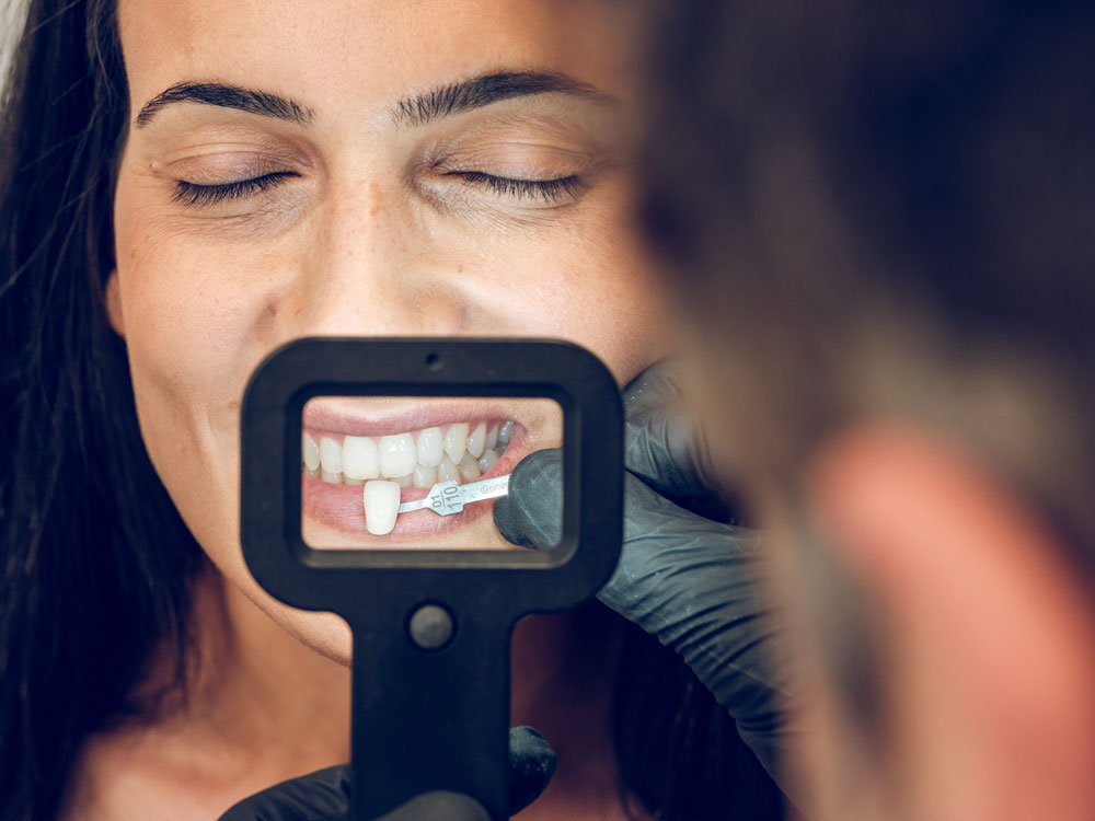dentist-picking-sample-of-teeth-porcelain-veneer-for-woman-