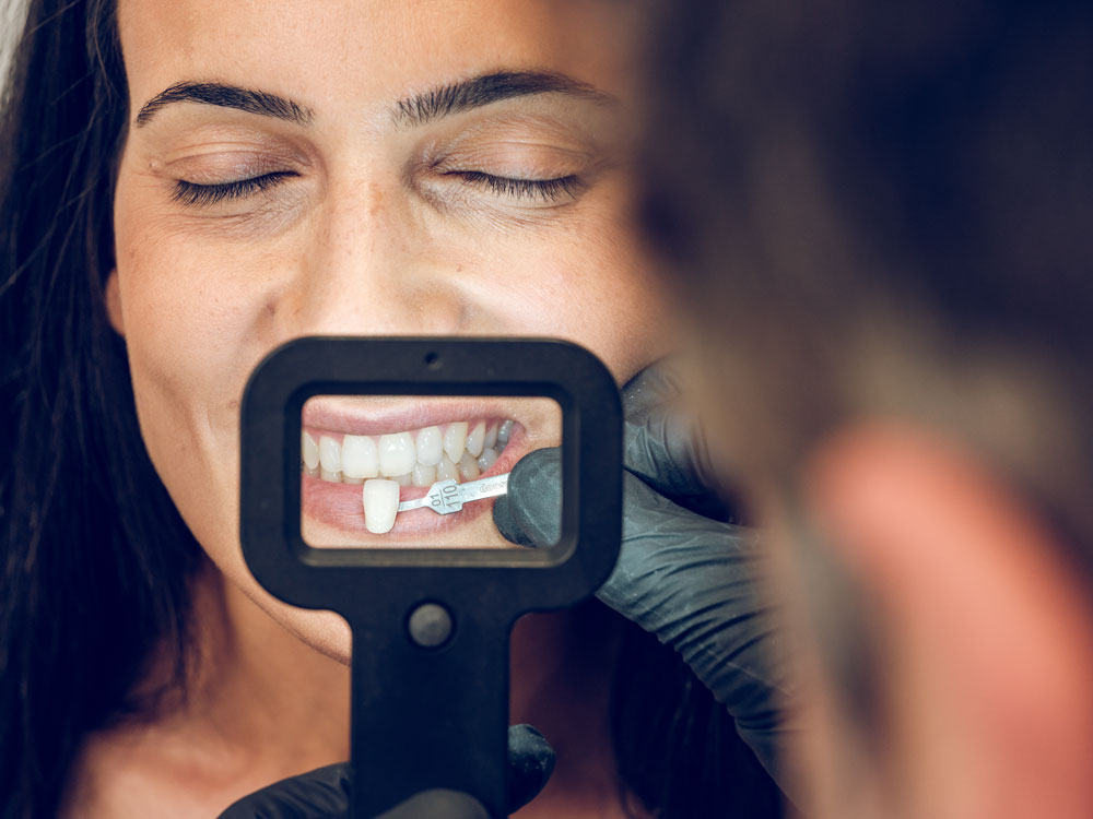 How Many Porcelain Veneers Do I Need? dentist-picking-sample-of-teeth-porcelain-veneer-for-woman-