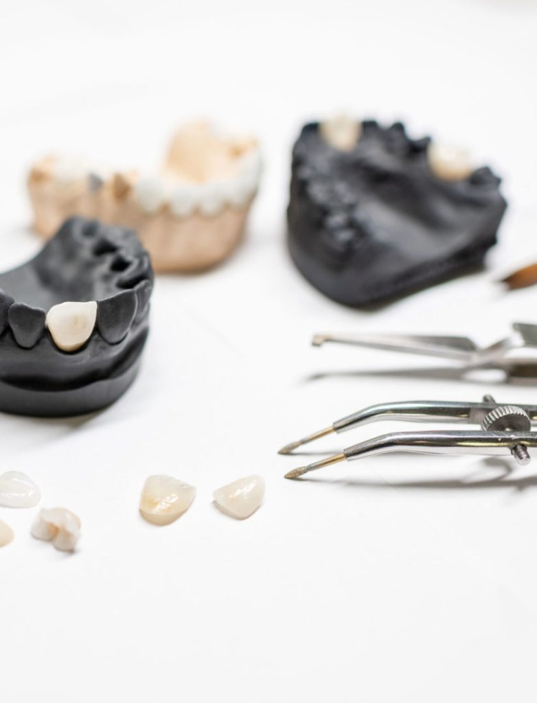 high-quality-porcelain-veneers