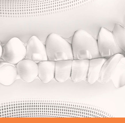 A short-code title for an Invisalign image. Smile Concepts uses this for efficient web loading. The visual likely shows aligners. The theme is quick visual. The alt text emphasizes the simplicity and effectiveness of the Invisalign system, a core service at the clinic for straightening teeth without braces.