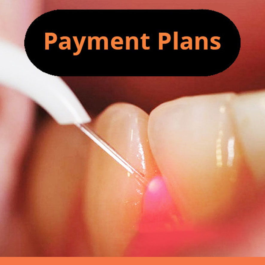 root canal treatment in sydney cheap root canal cost