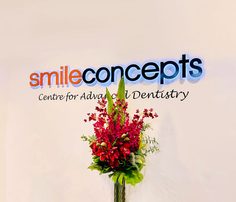 contact-smile-concepts-for-porcelain-veneers