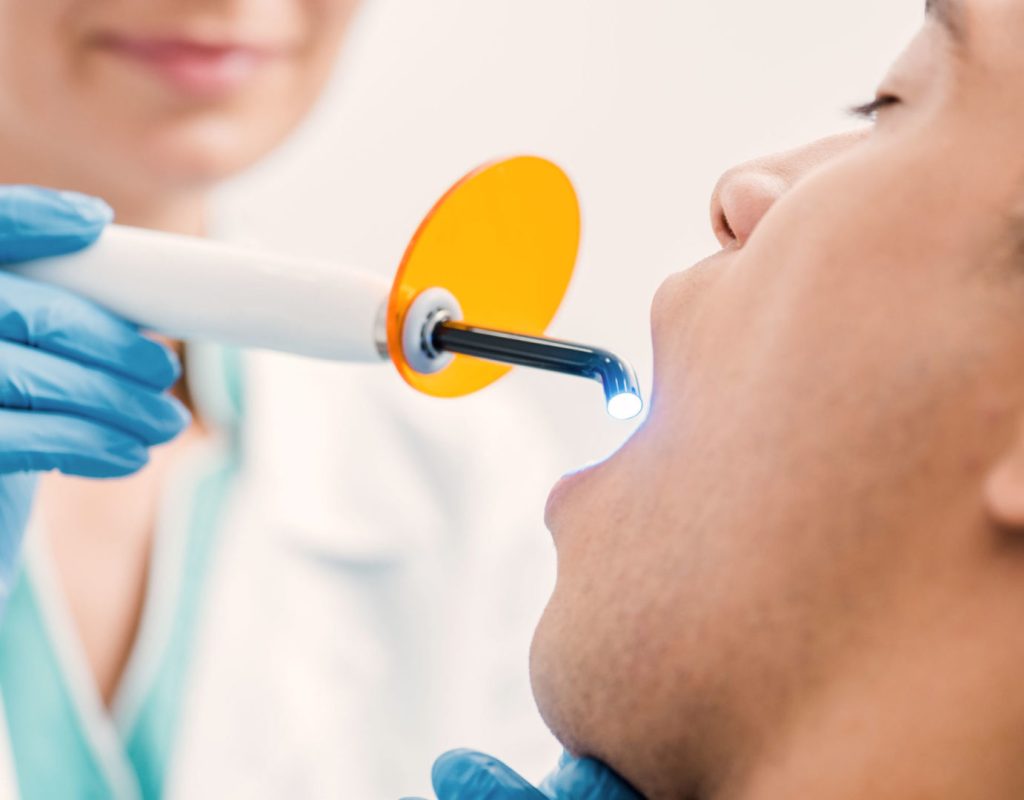 laser-gum-bleaching-2