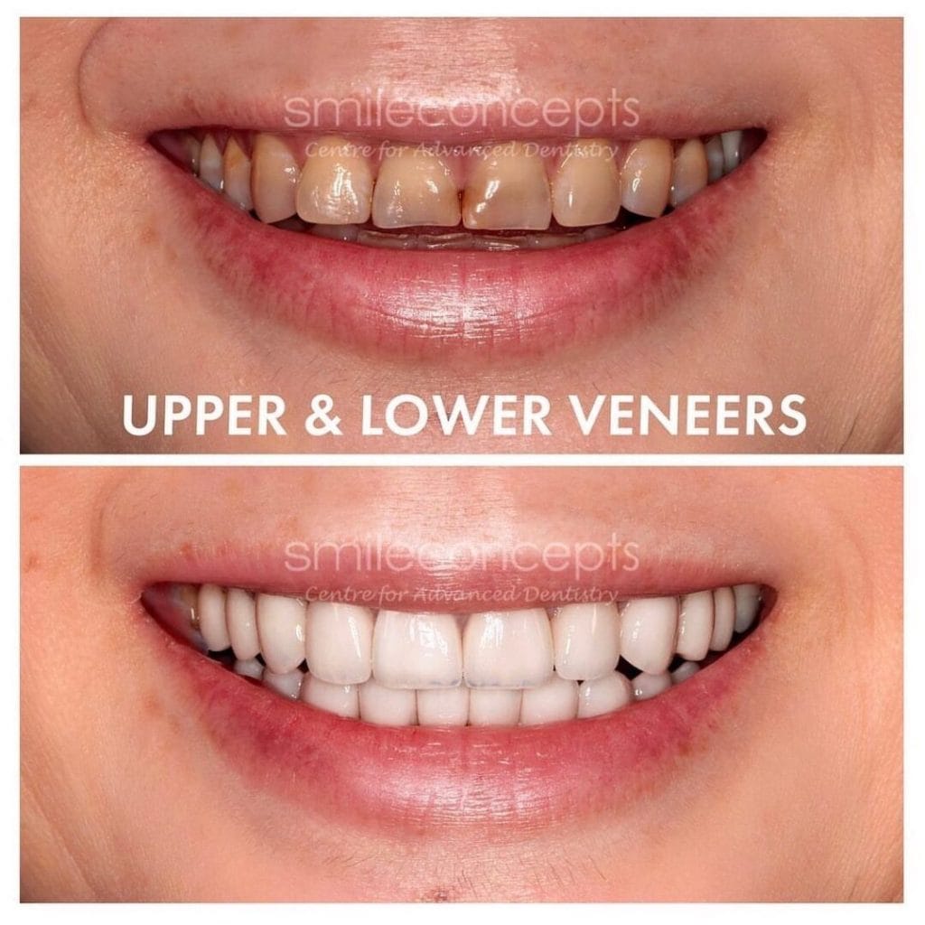 Smile Comparison