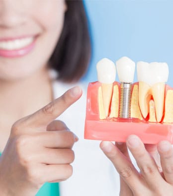 dental-implants-thumbnail