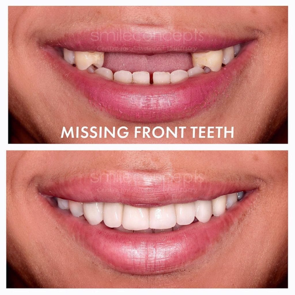 Smile Comparison