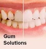 gum_solutions
