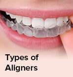 aligners