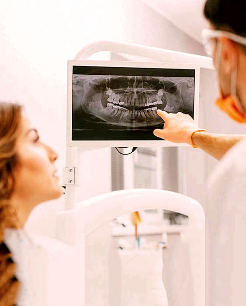 Dental Implants Sydney